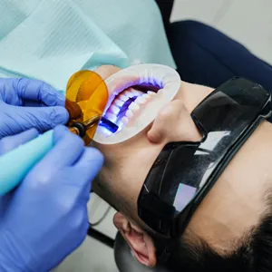 32390 teeth whitening sacramento