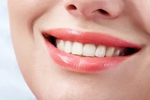 32392 teeth whitening aurora co kits