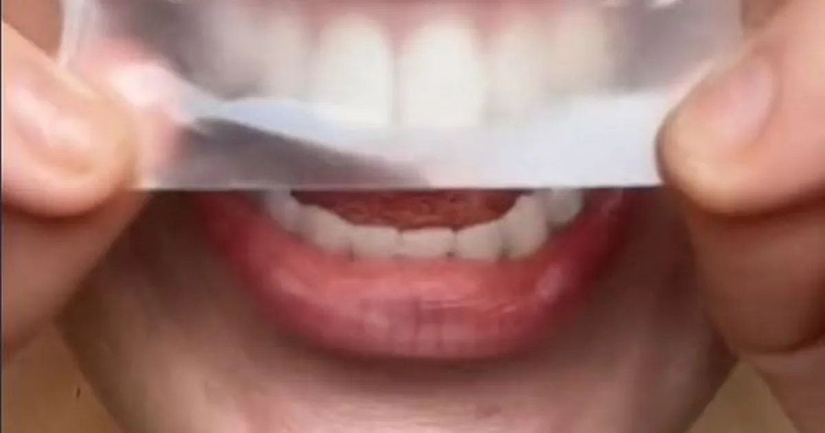 32401 teeth whitening process