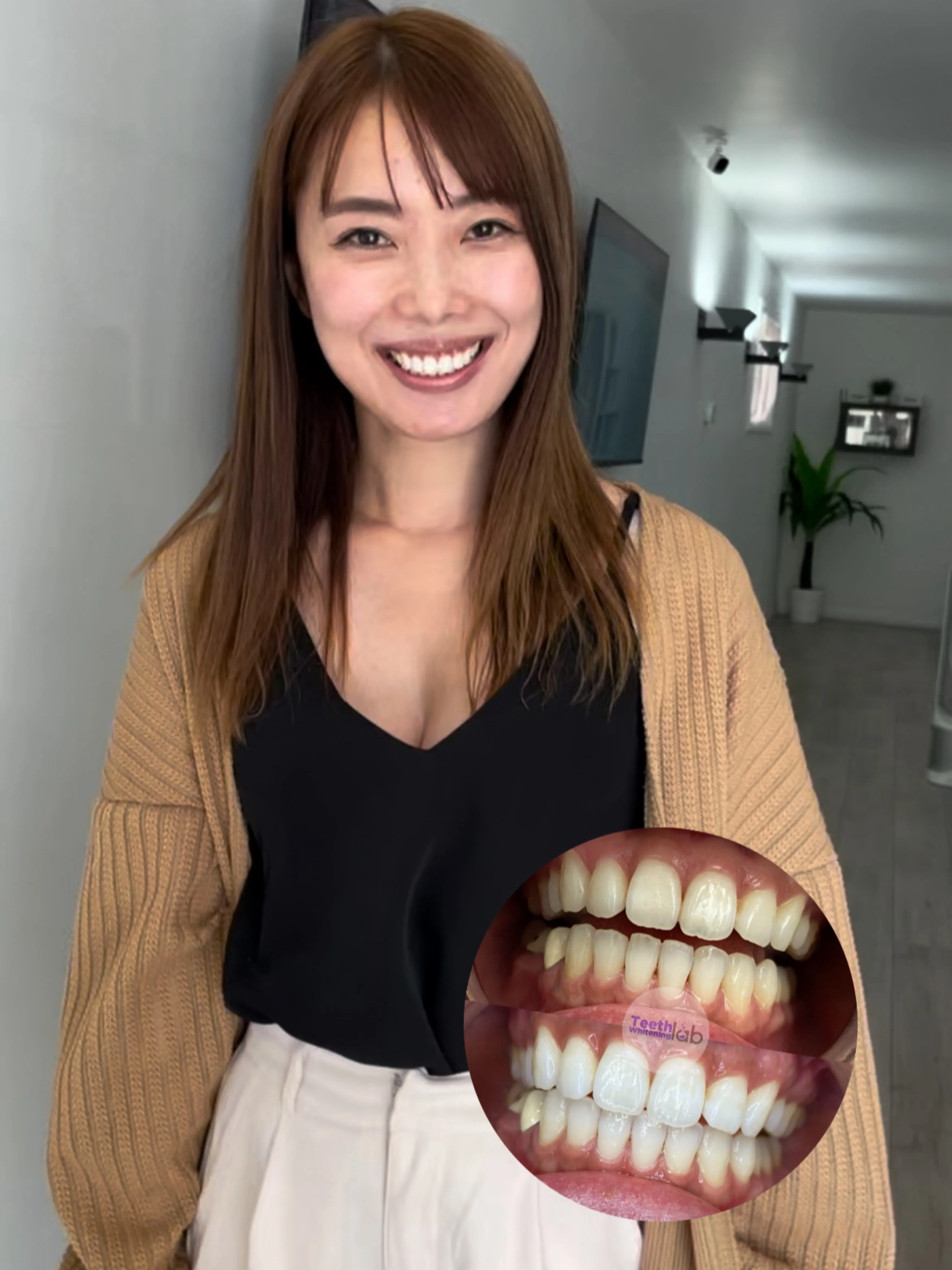 32404 oral hygiene routine