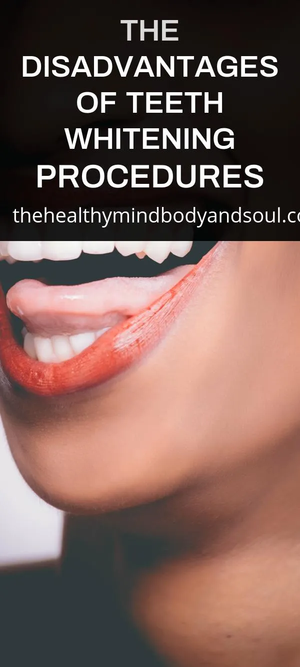 32410 teeth whitening cost