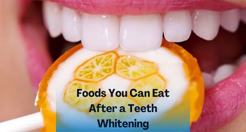 32412 types of teeth whitening