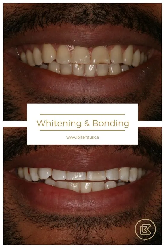 32415 confident smile