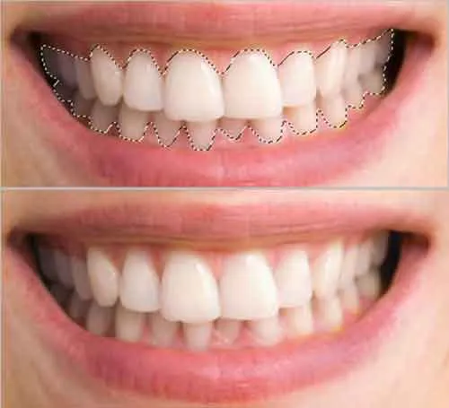 32421 photoshop cc teeth whitening before after