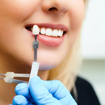 32425 teeth whitening midland tx 3