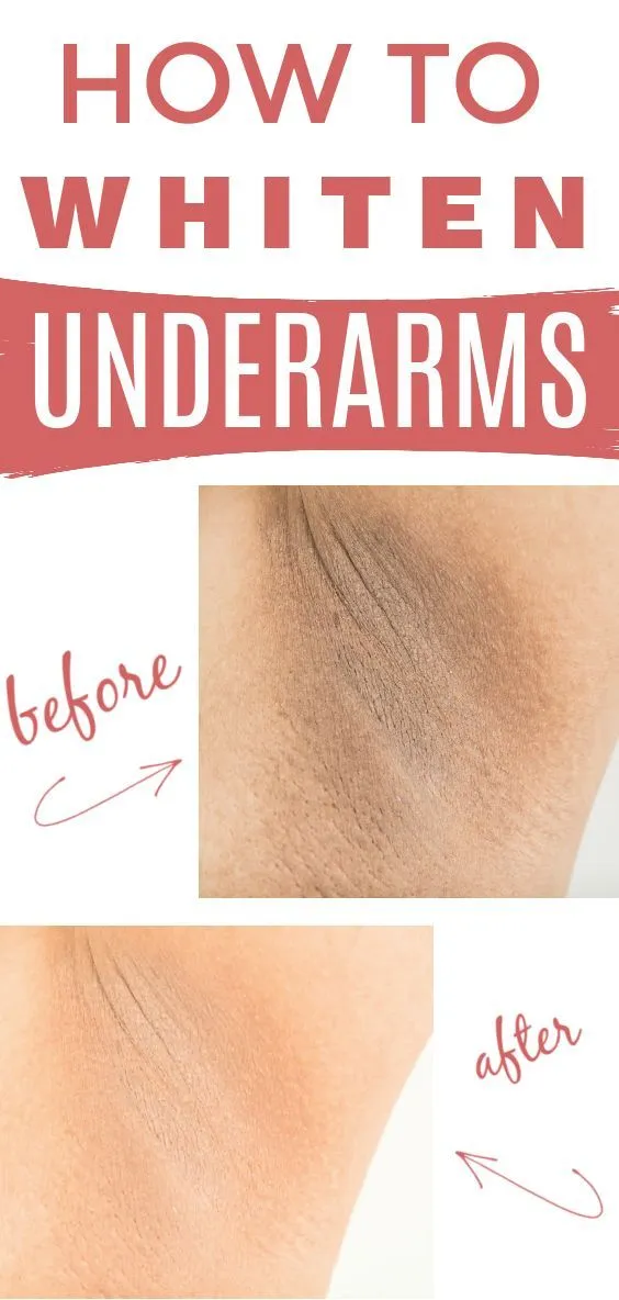 32430 deodorant irritation