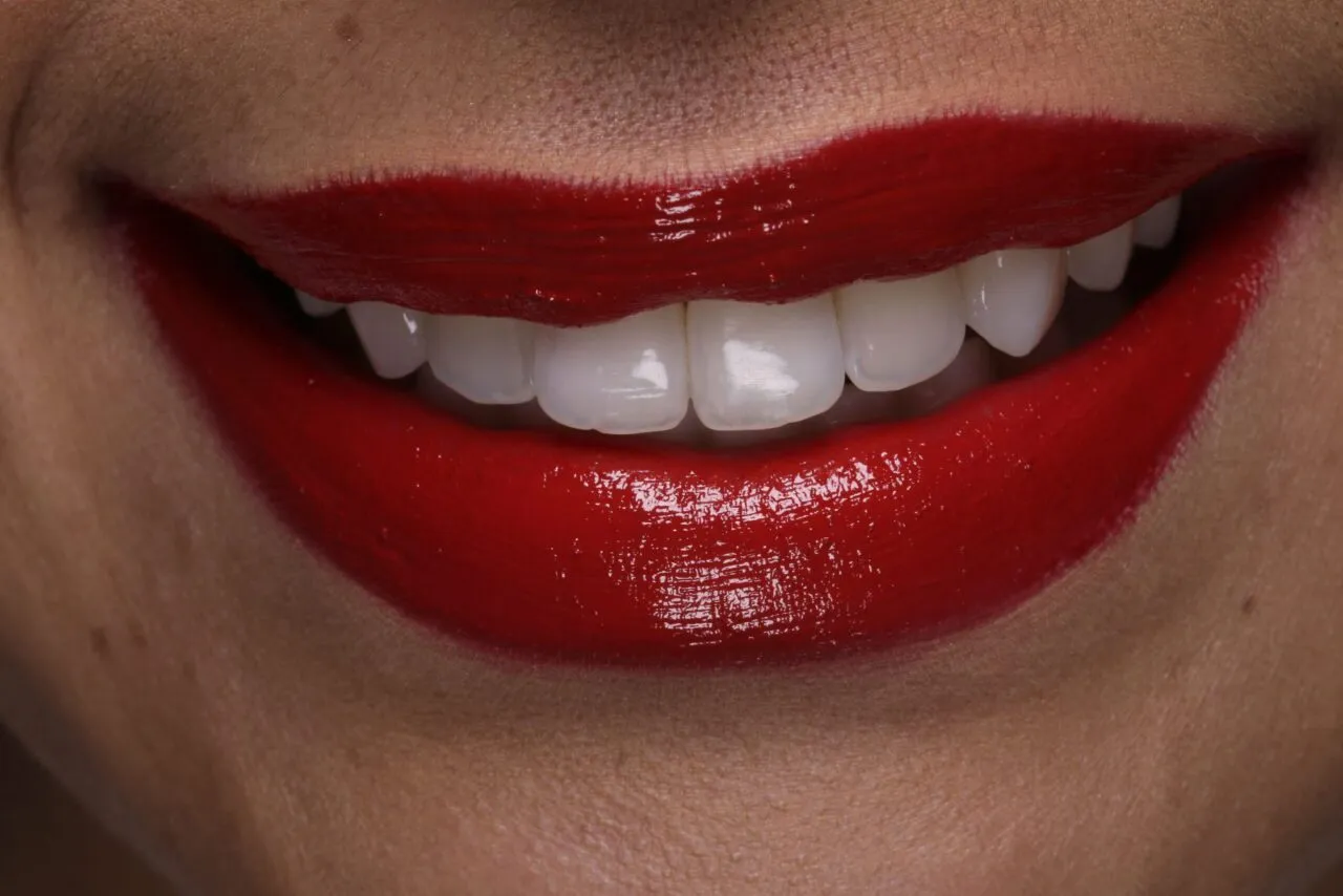 32432 maintaining white teeth