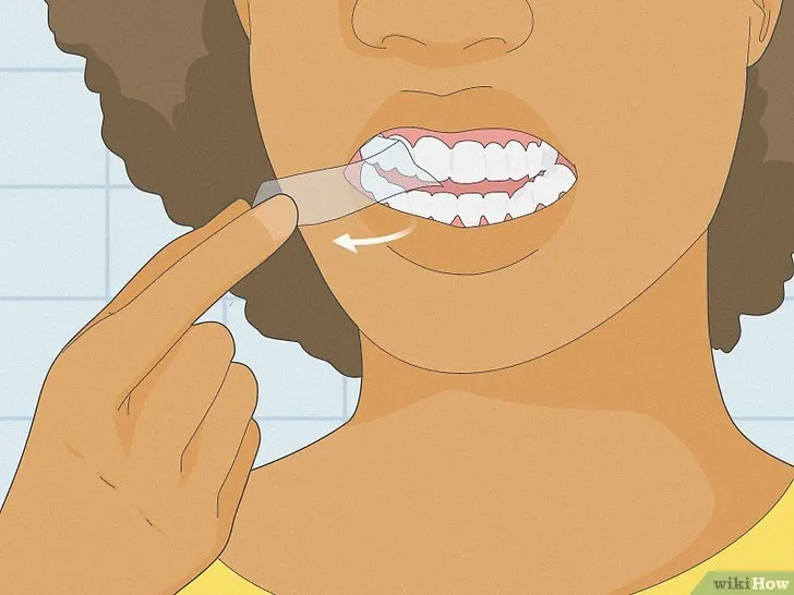 32438 types of whitening strips