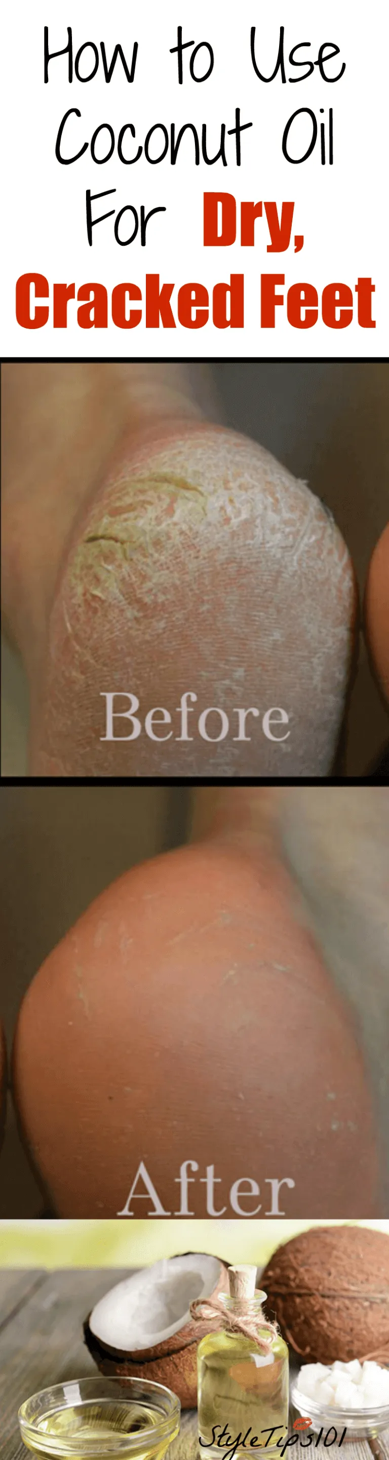 /img/32440-coconut-oil-feet-whitening-honey.webp