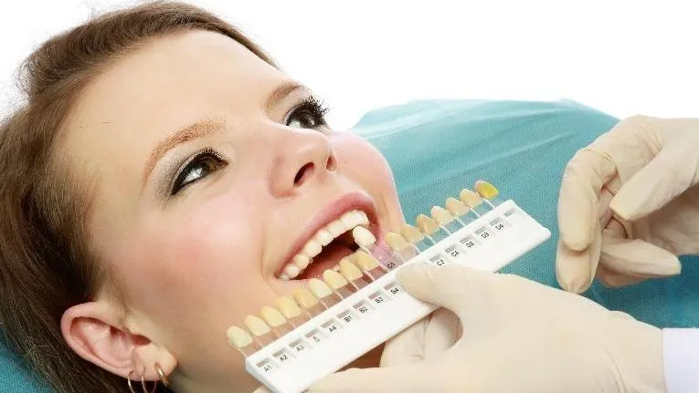 32445 in office teeth whitening