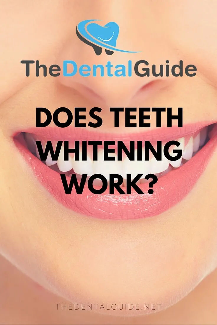 32452 oral health teeth whitening