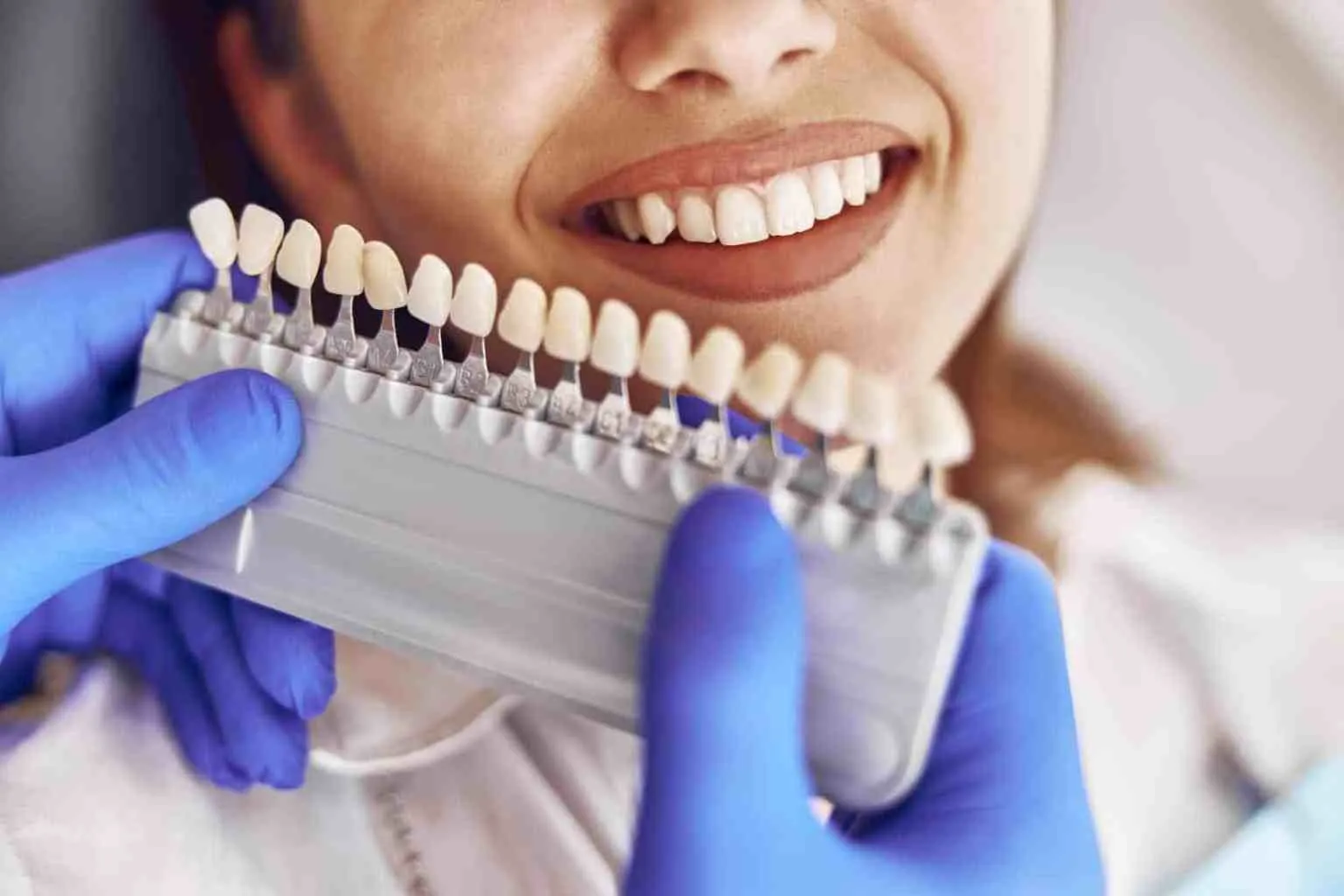 32452 professional teeth whitening