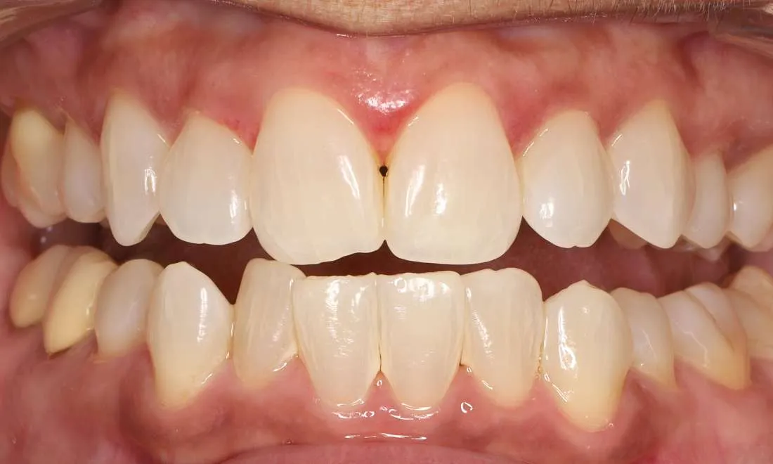 32453 dentist whitening consultation