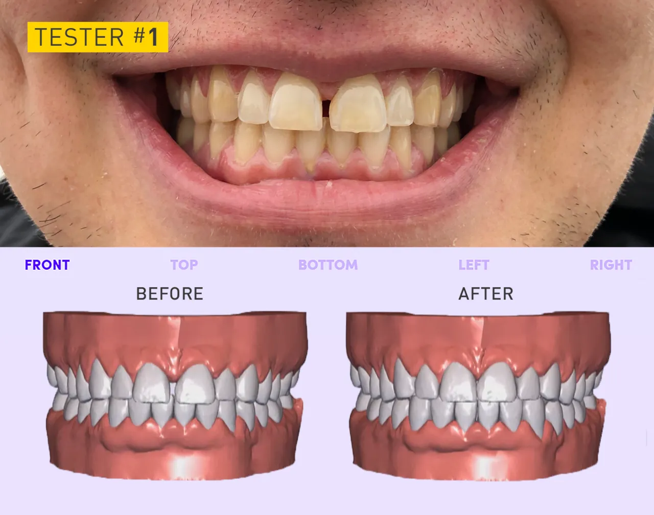 32454 fluoride benefits