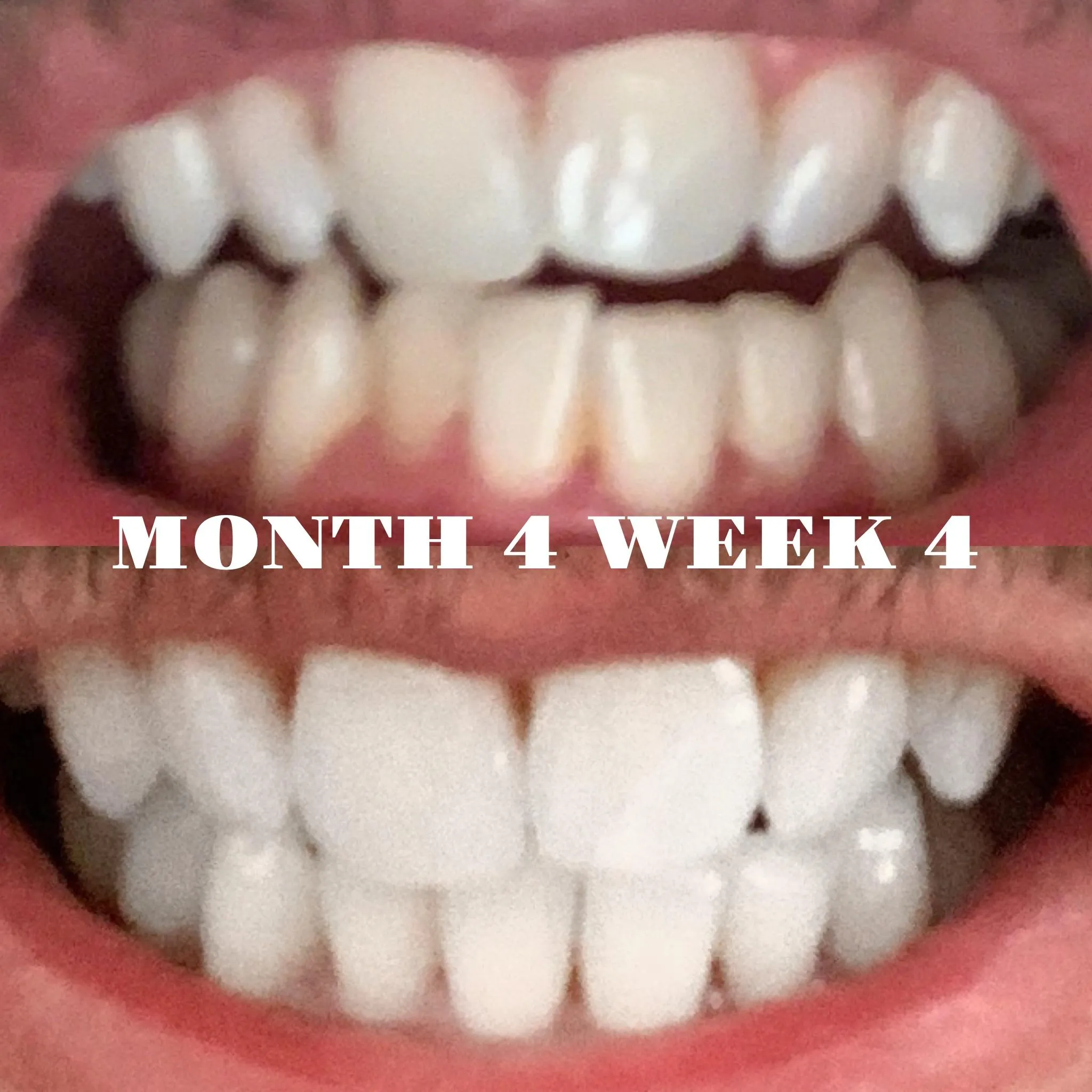 32454 whitening agents