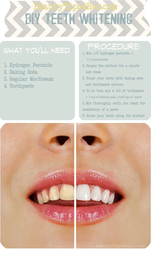 32457 hydrogen peroxide teeth
