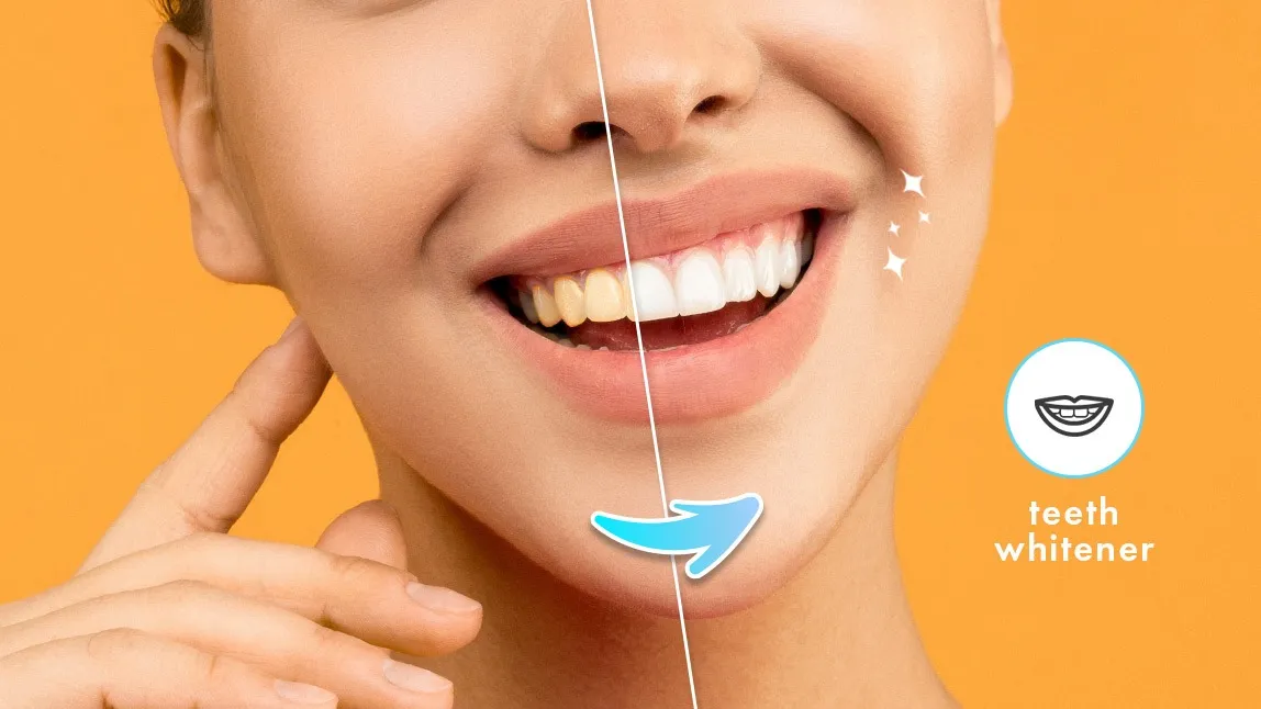 32460 teeth whitening app user review
