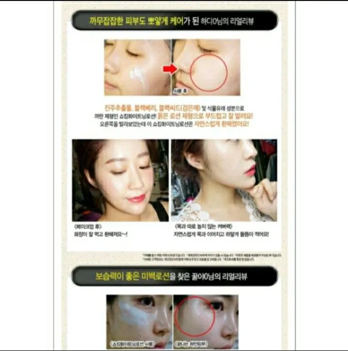 32465 skin irritation whitening lotion