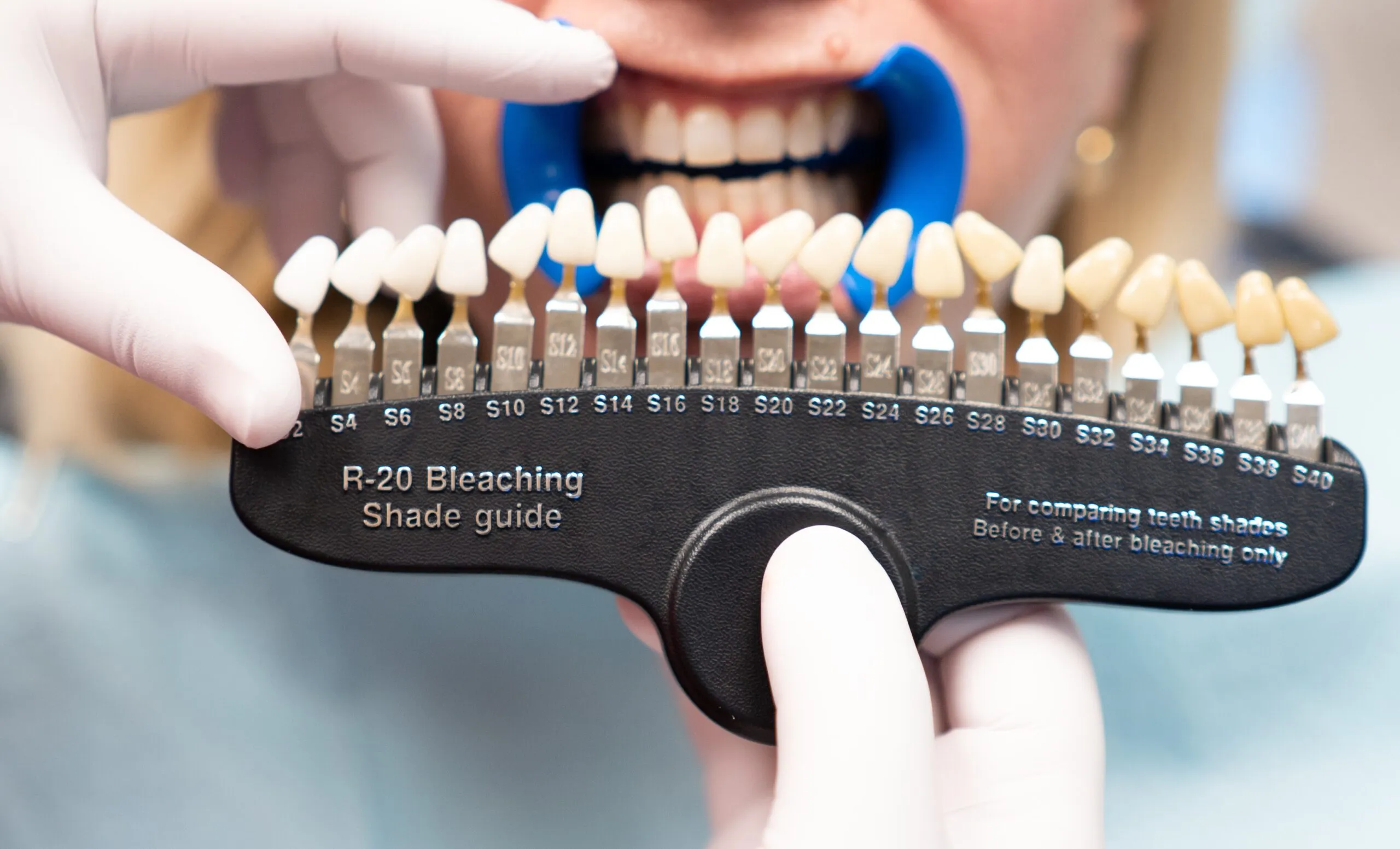 32468 teeth discoloration causes