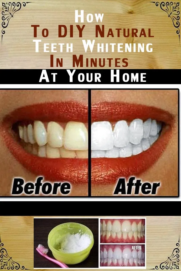 32469 hydrogen peroxide teeth whitening