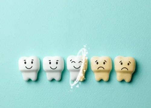 32474 teeth whitening goodyear az smile