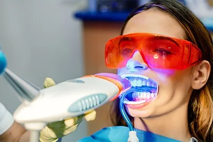 32475 laser teeth whitening