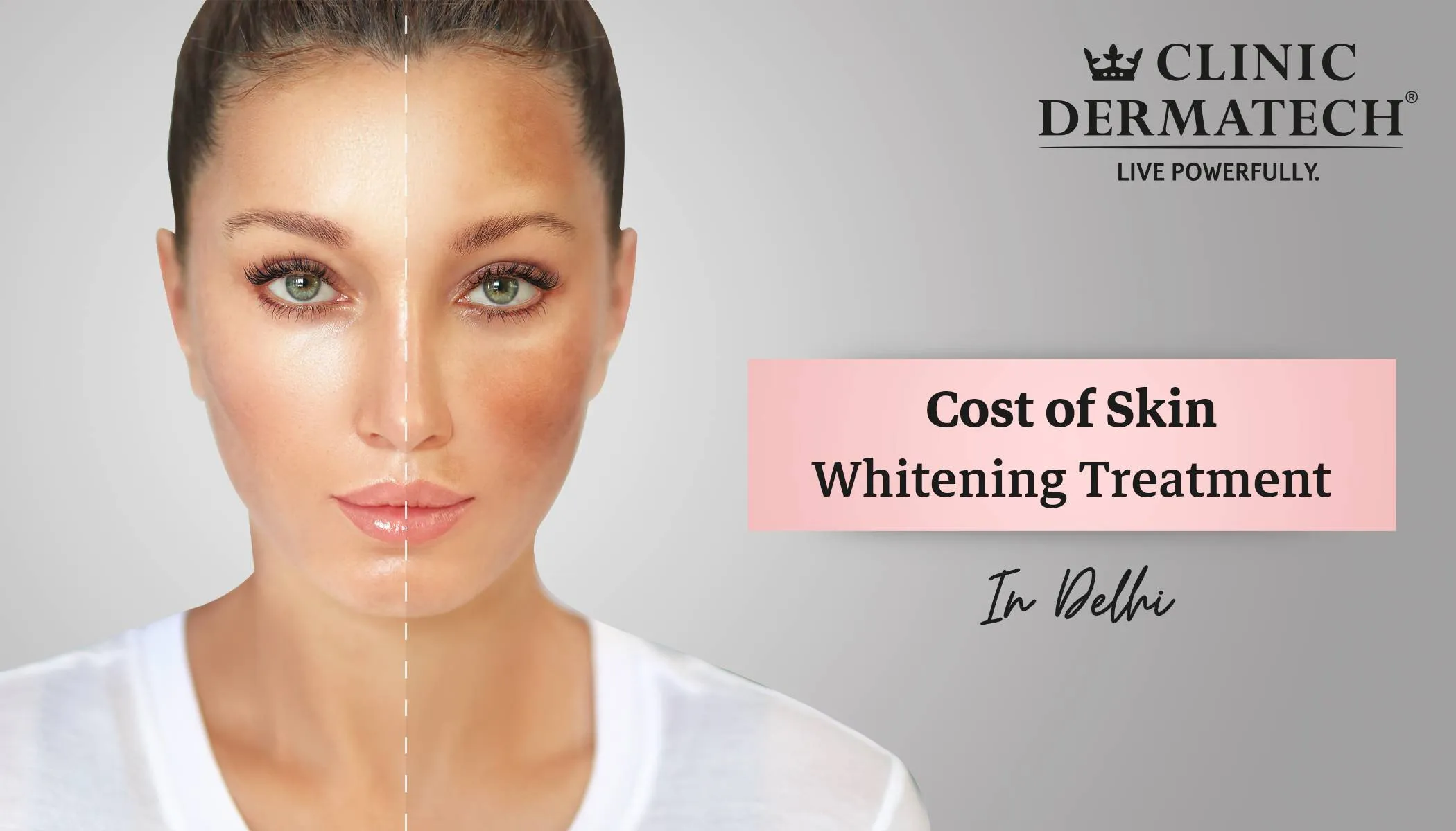 32478 skin whitening cost trivandrum