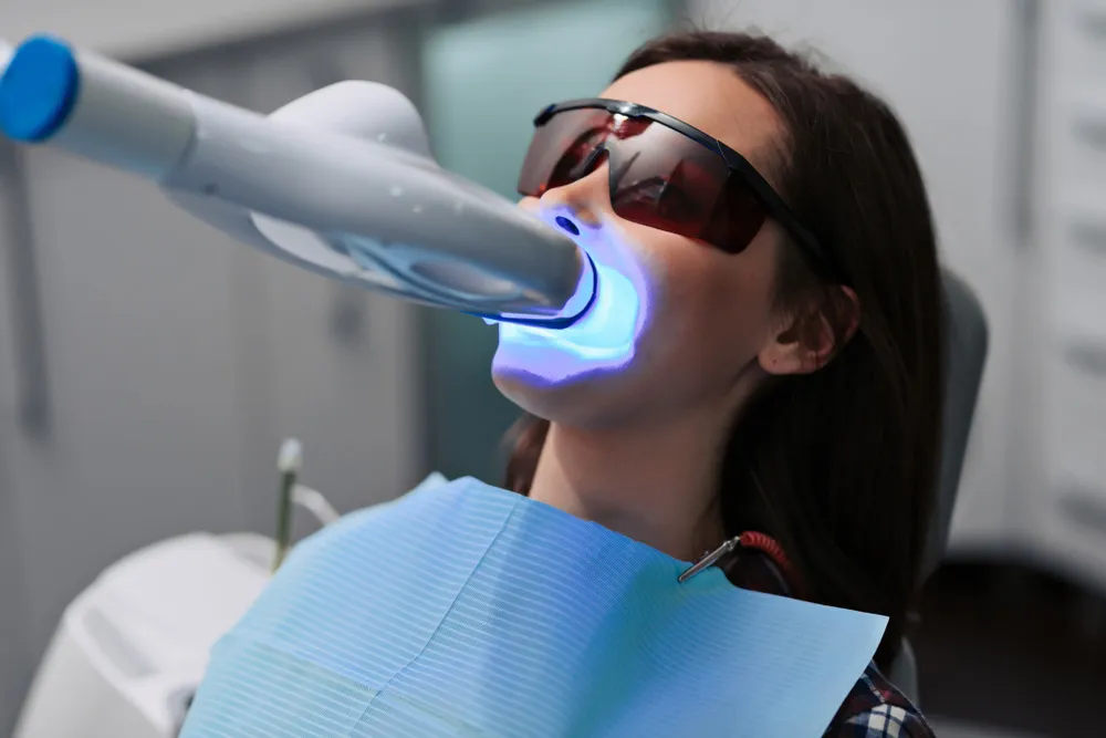 32479 teeth whitening eugene or 6