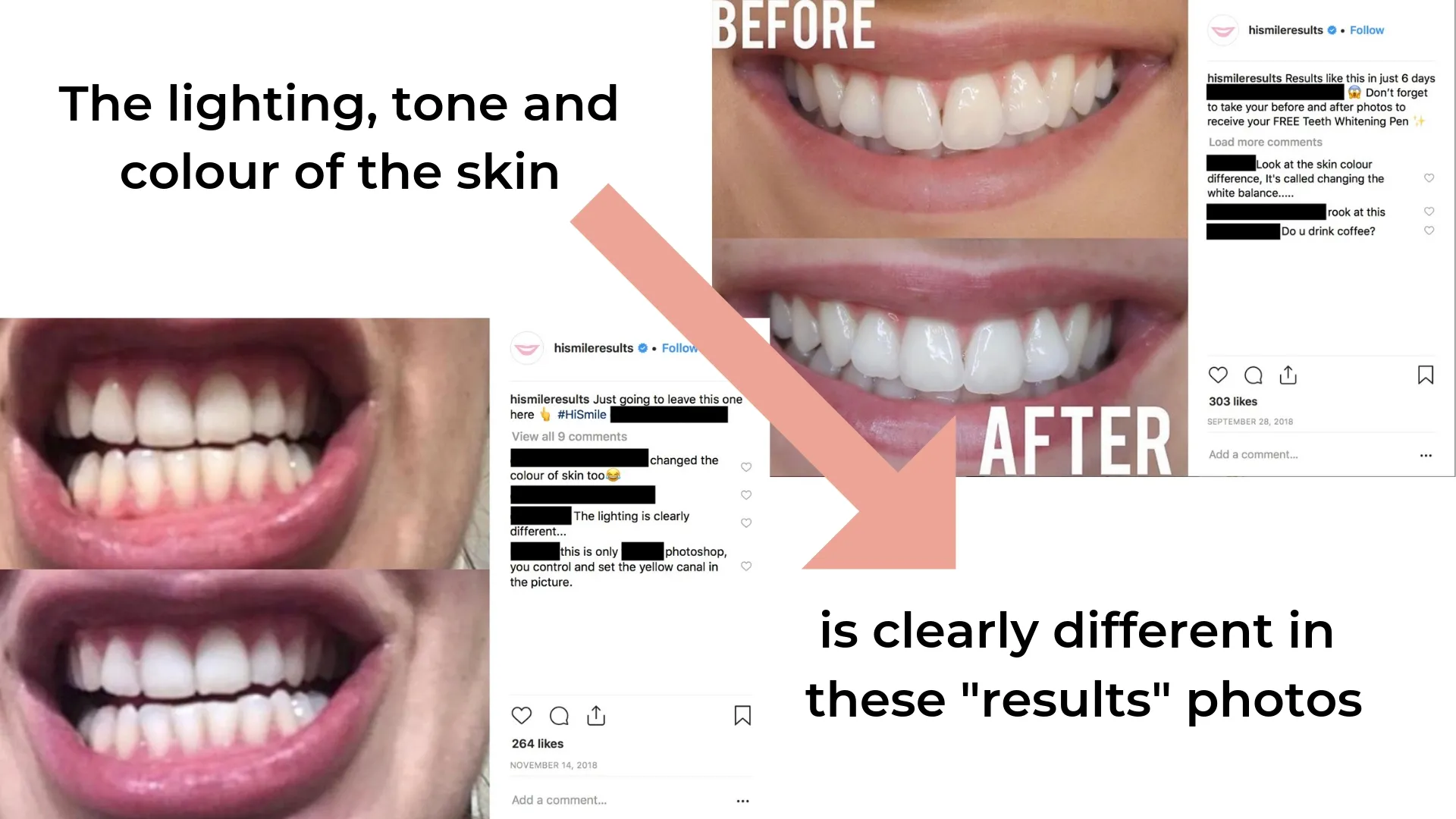 32483 smiling woman after whitening