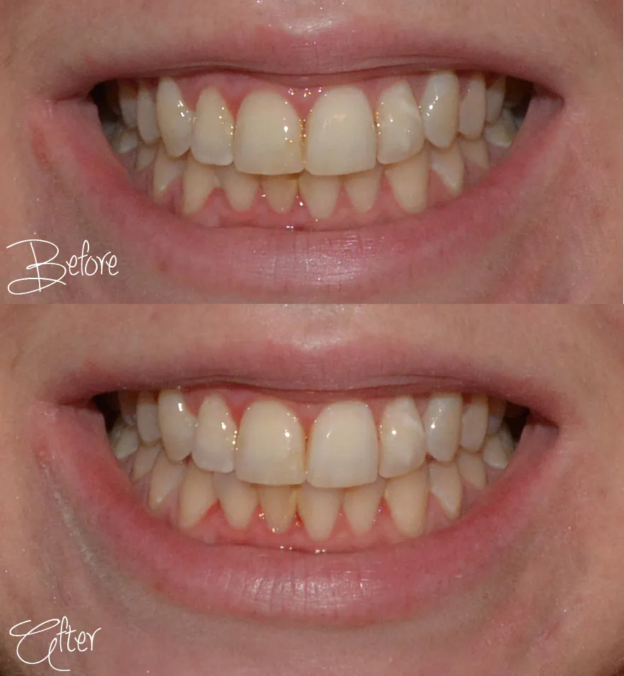 32485 healthy teeth and gums