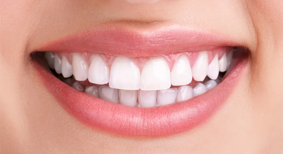 32493 teeth whitening nashua nh smiling