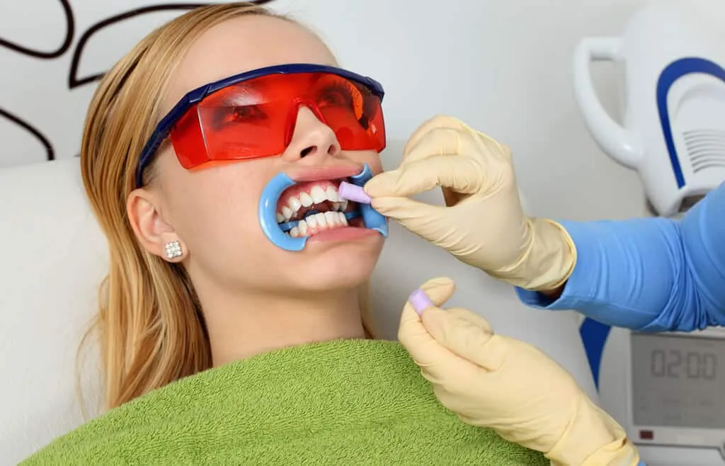 32493 teeth whitening nashua nh youthful appearance