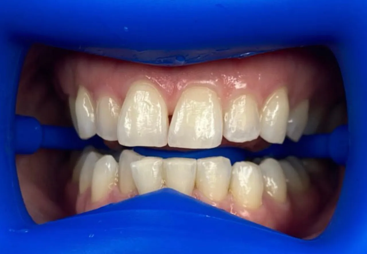 32498 bright smile social life