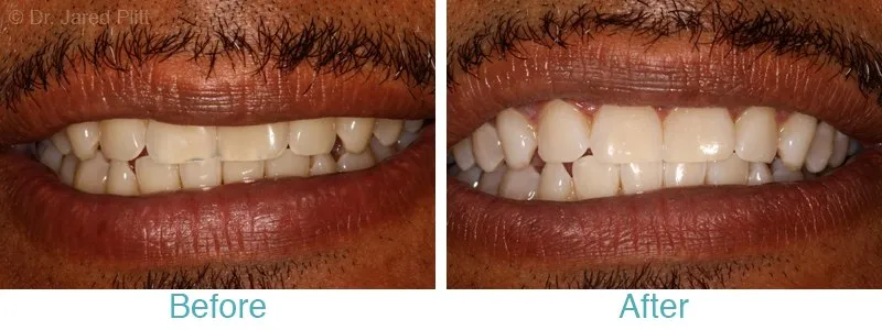 32509 avoiding staining foods