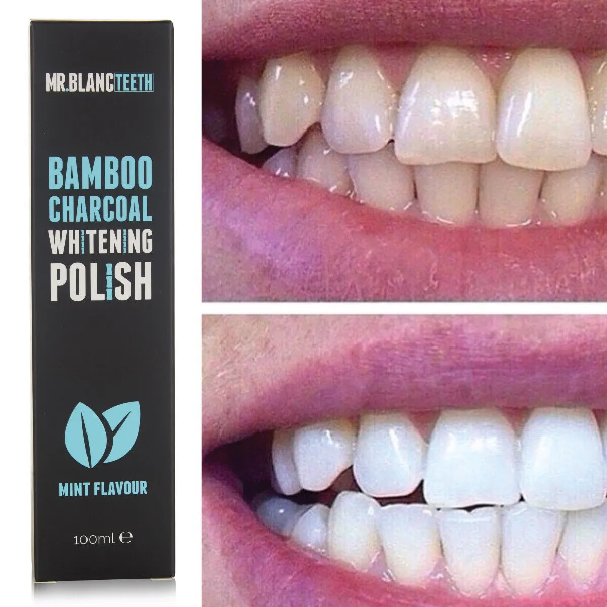 32518 healthy whitening foods