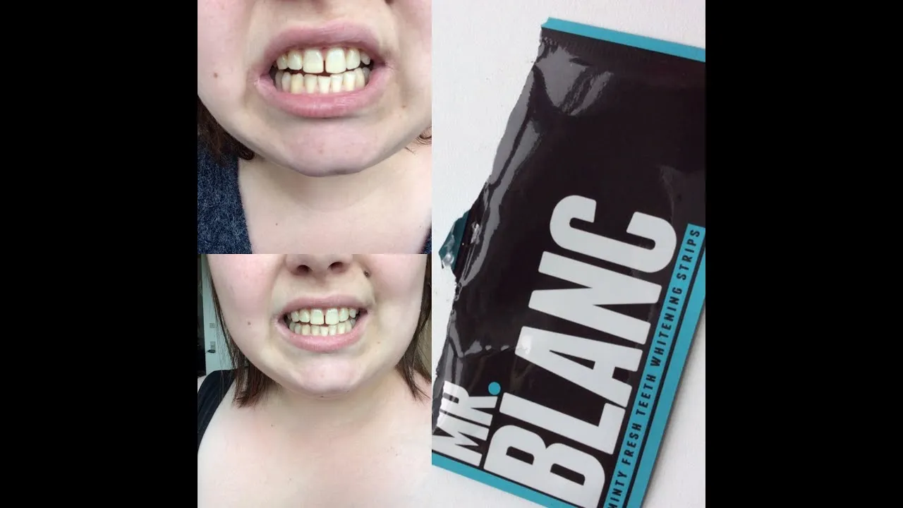 32518 proper brushing techniques