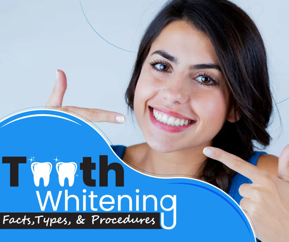 32523 teeth whitening options