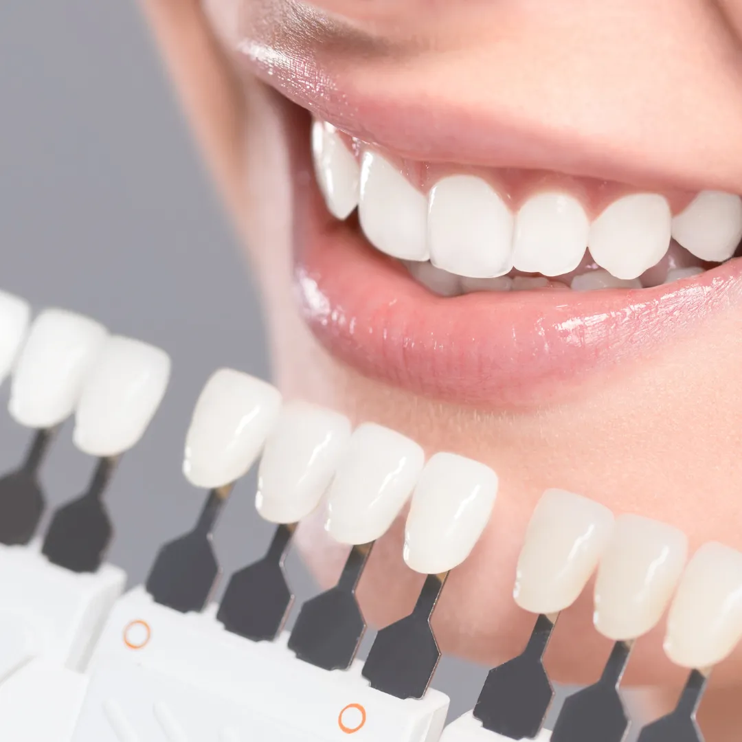 32523 teeth whitening science