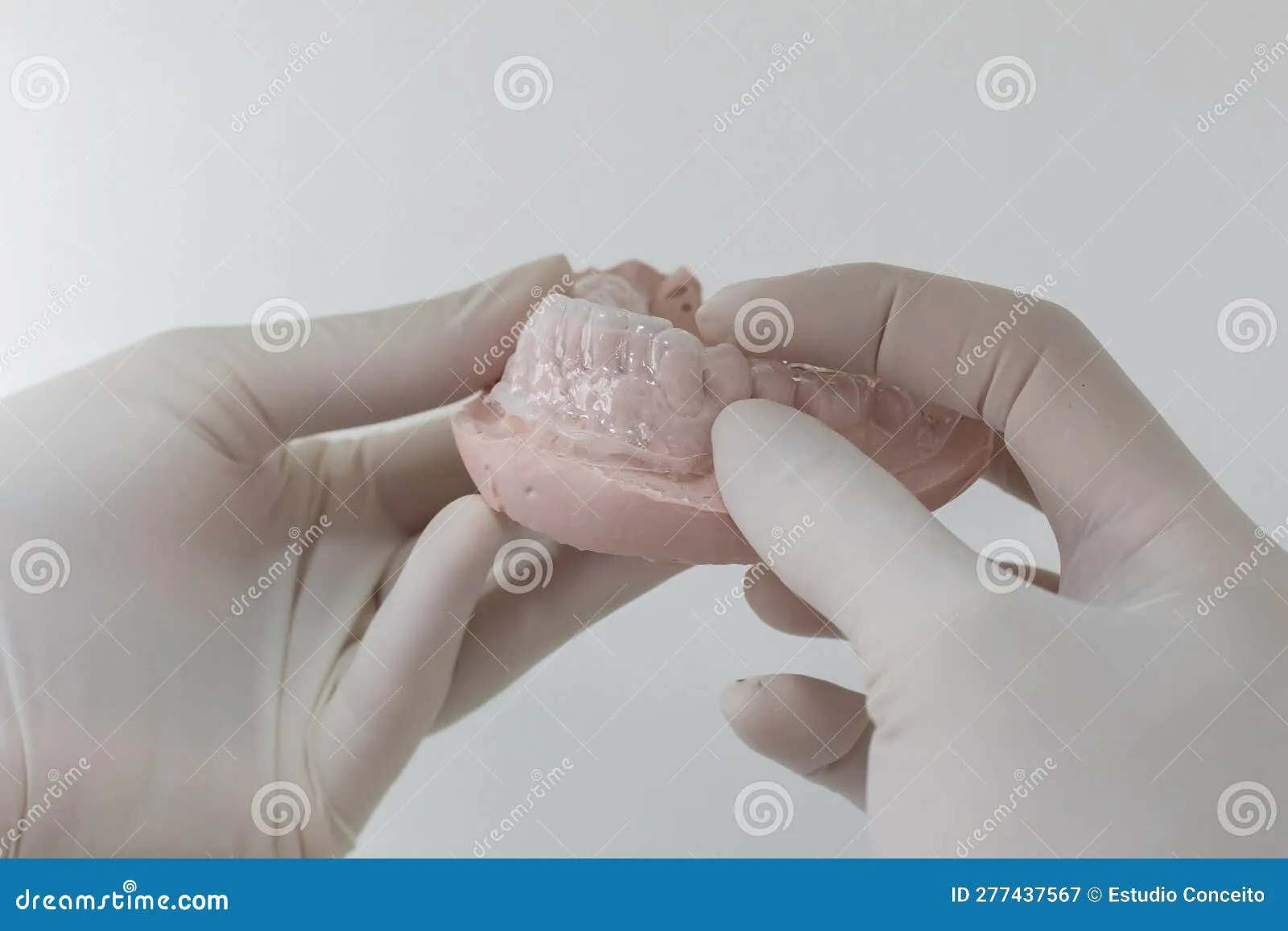 32524 types of teeth whitening