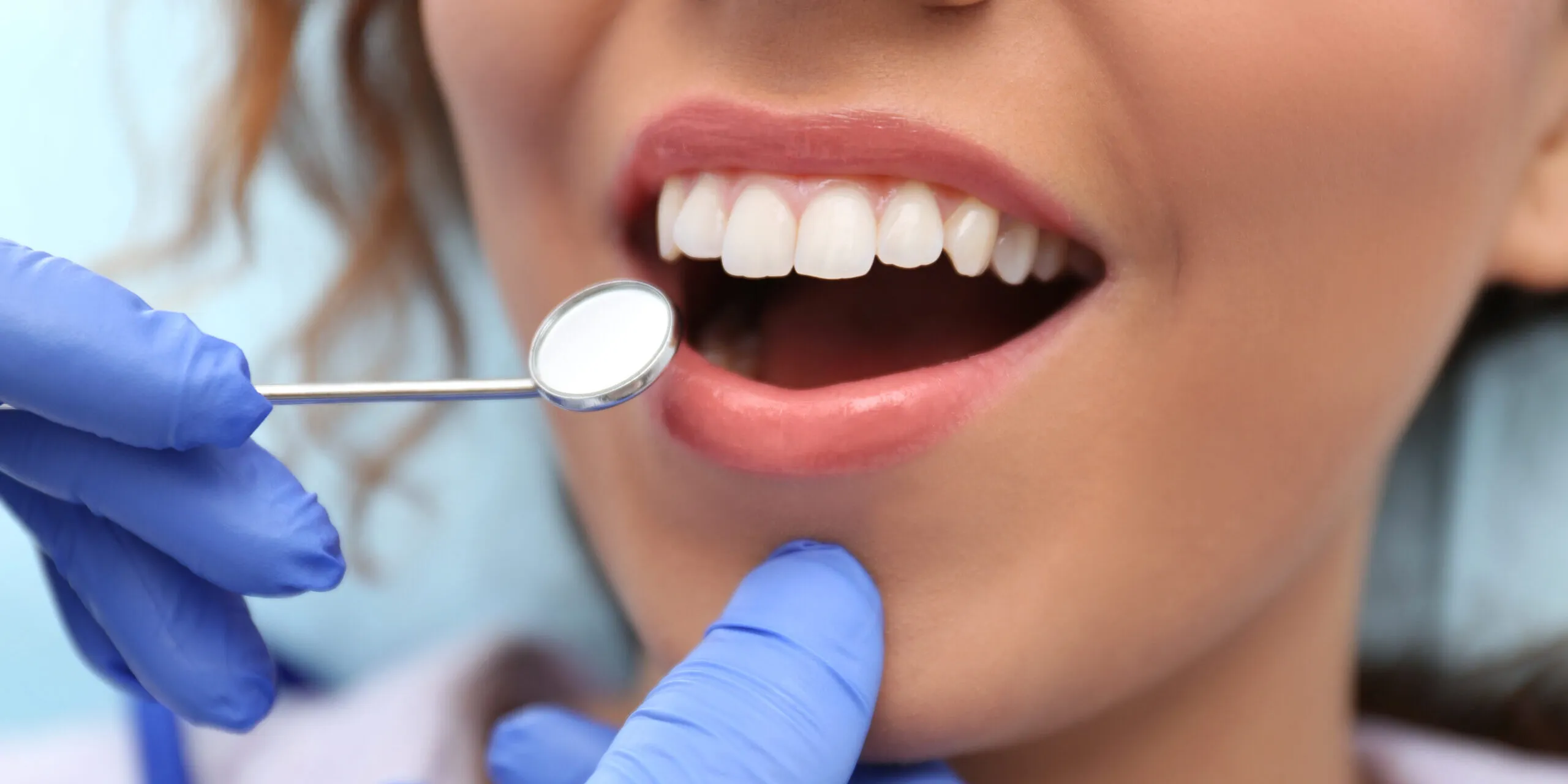 32526 at home teeth whitening