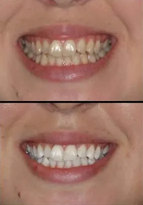 32533 dental office teeth whitening