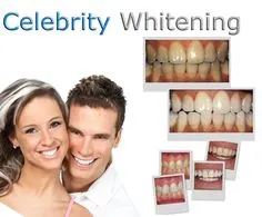 32537 teeth whitening clinic