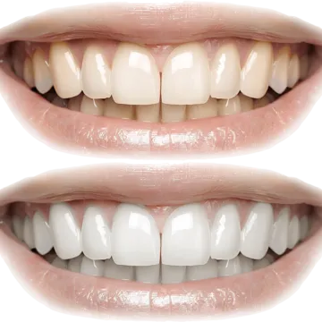 32538 long lasting whiteness