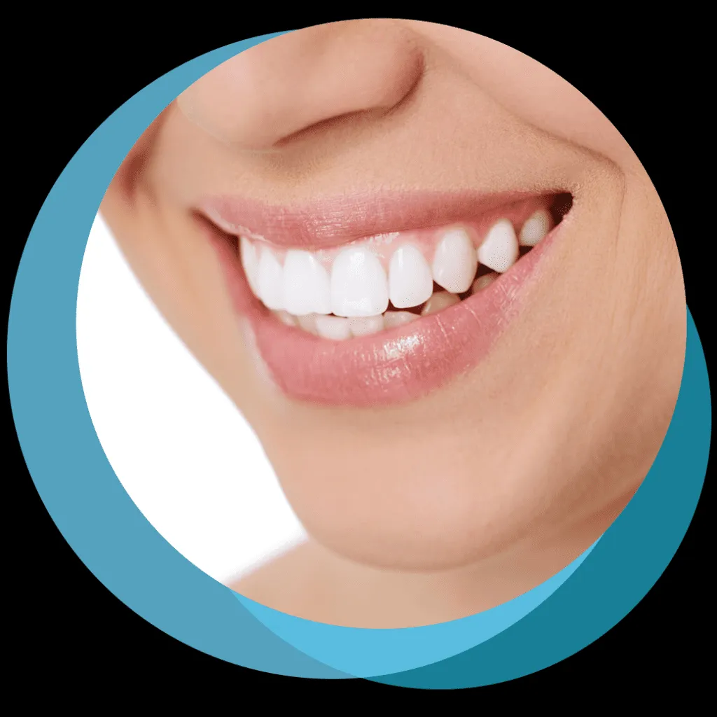 32538 teeth whitening options