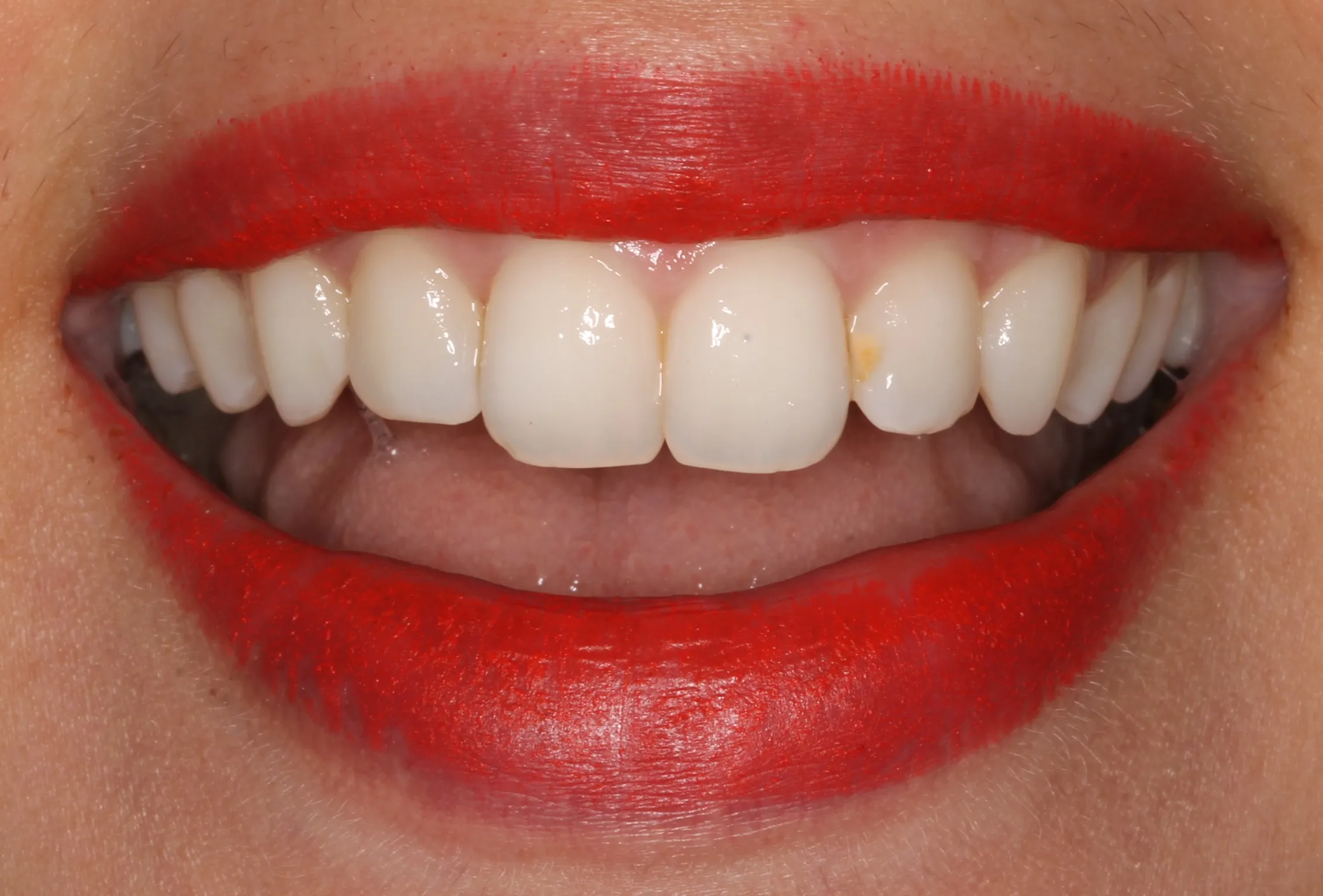 32539 dental hygiene