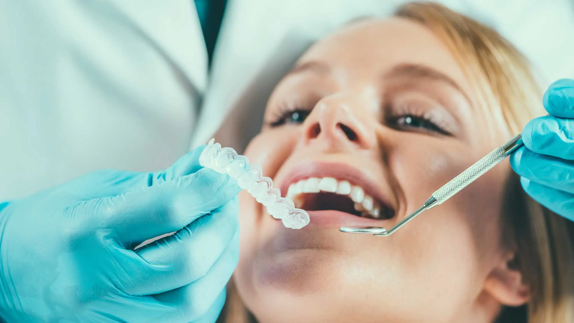 32539 teeth whitening comparison