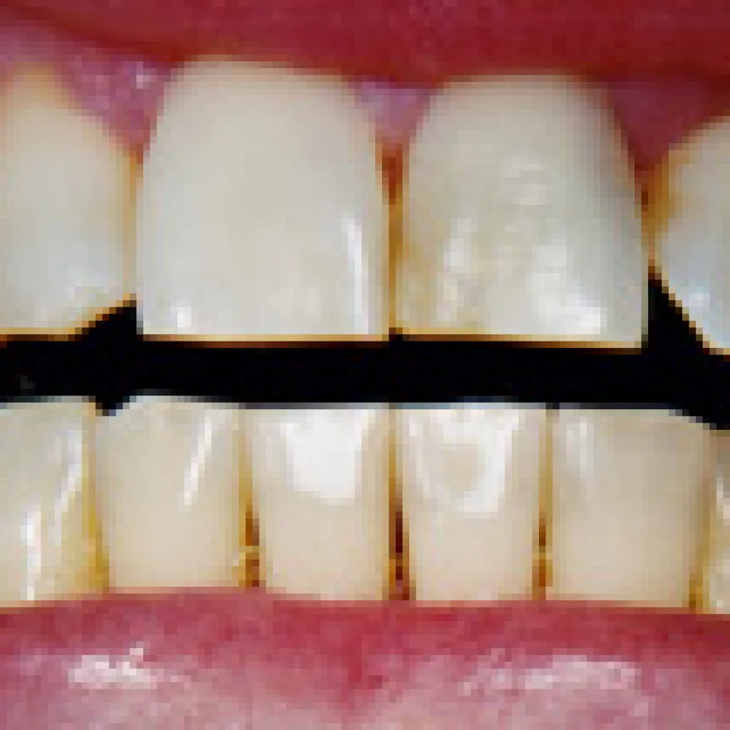 32548 sensitive toothpaste