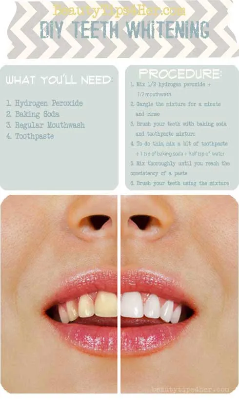 32550 teeth whitening methods diy intro
