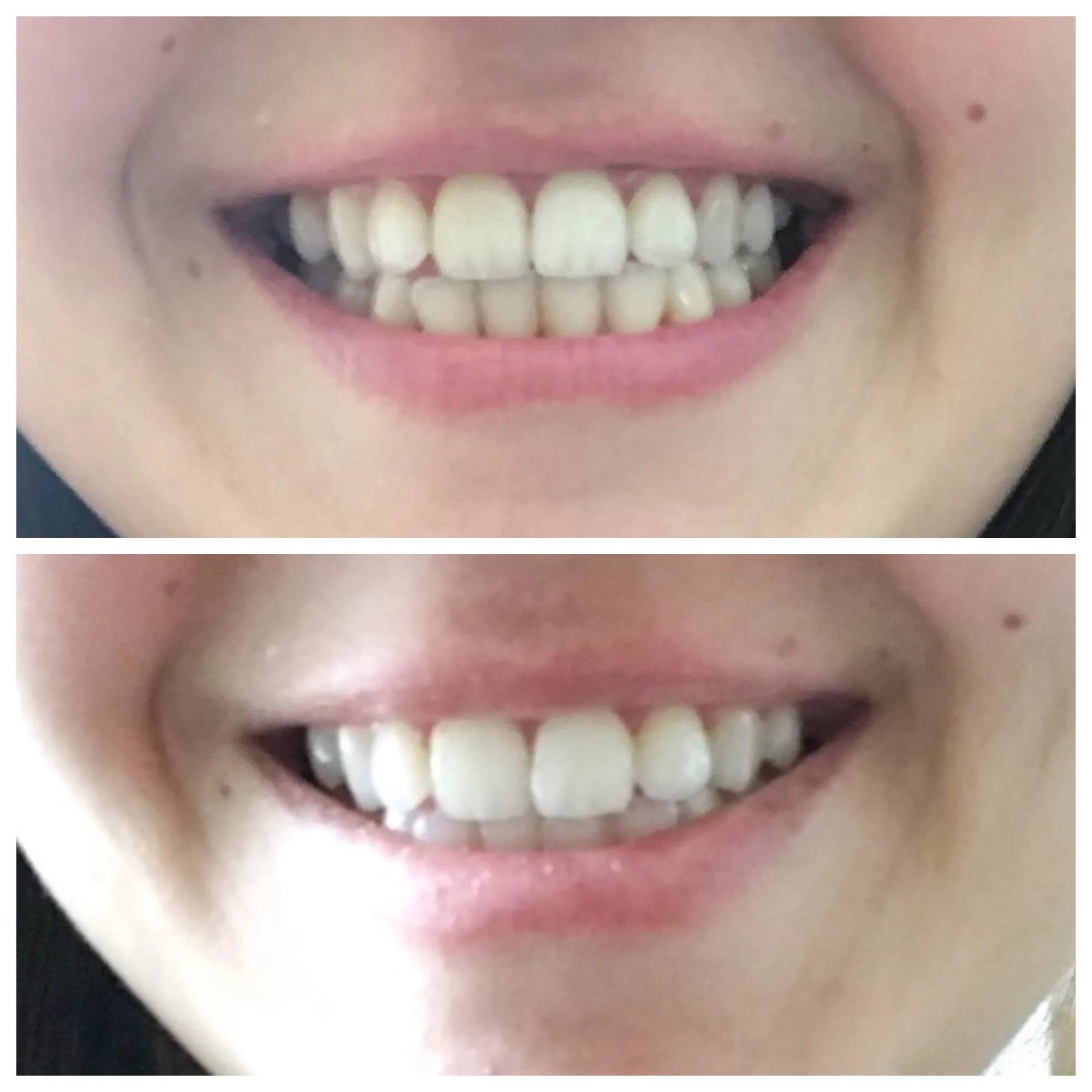 32555 oral hygiene tips