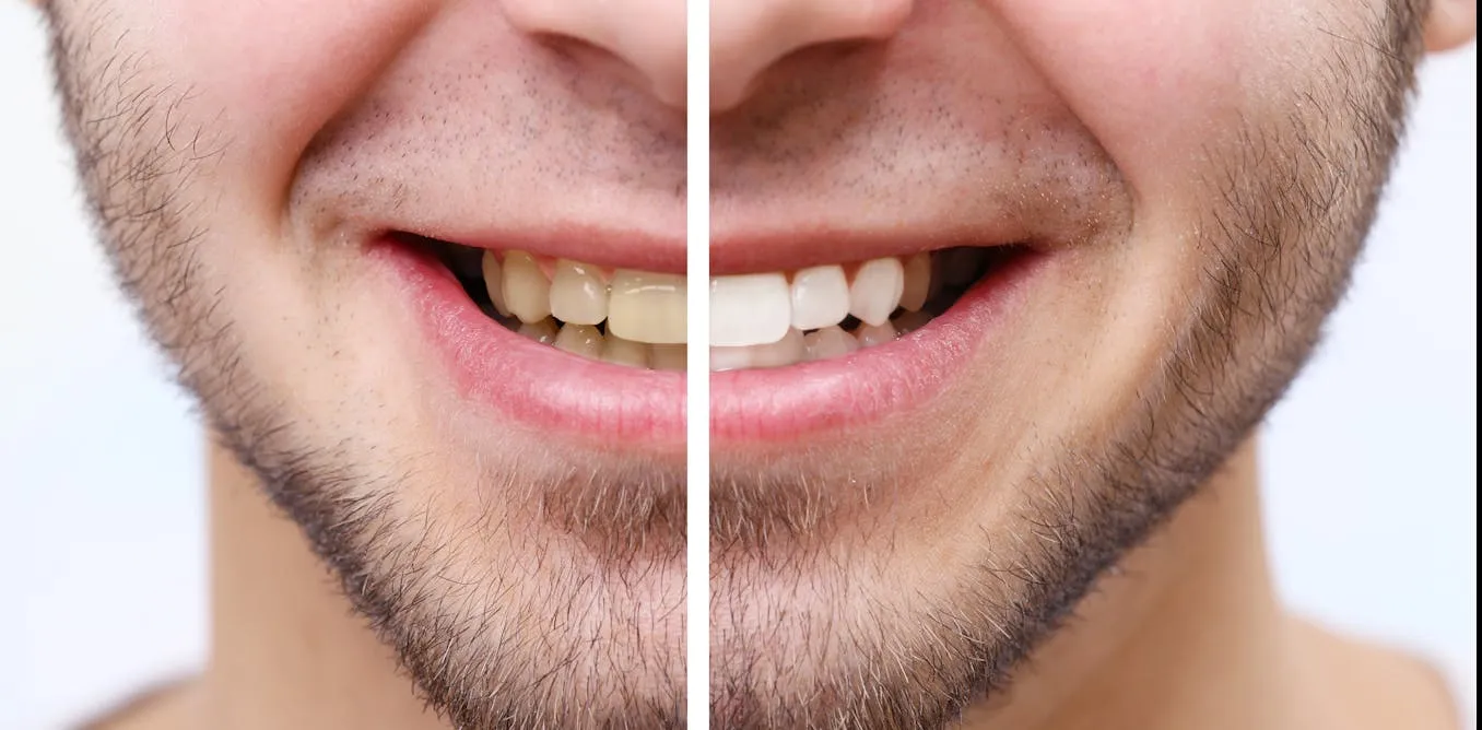 32561 tooth sensitivity